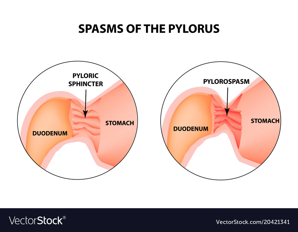 Spasming orgasms impregnating cream image