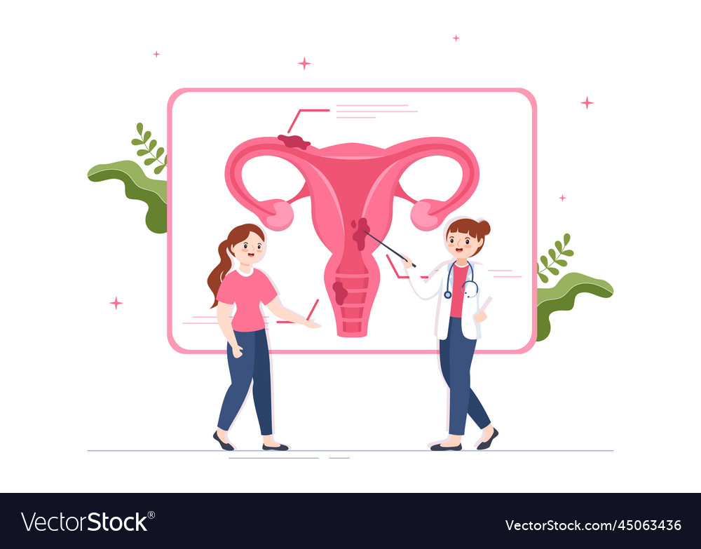 Endometriosis With Condition The Endometrium Vector Image