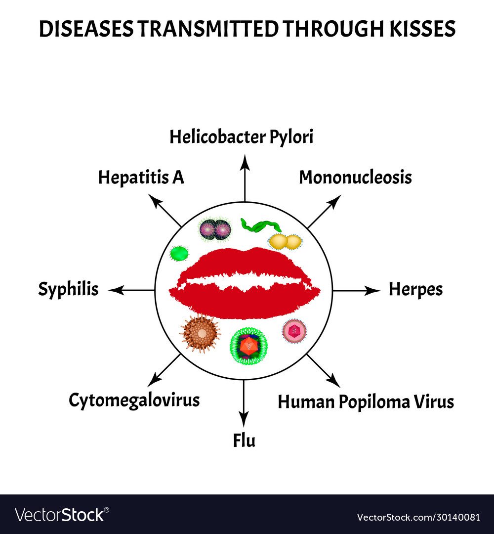 diseases-transmitted-through-kisses-syphilis-herpes-mononucleosis-riset