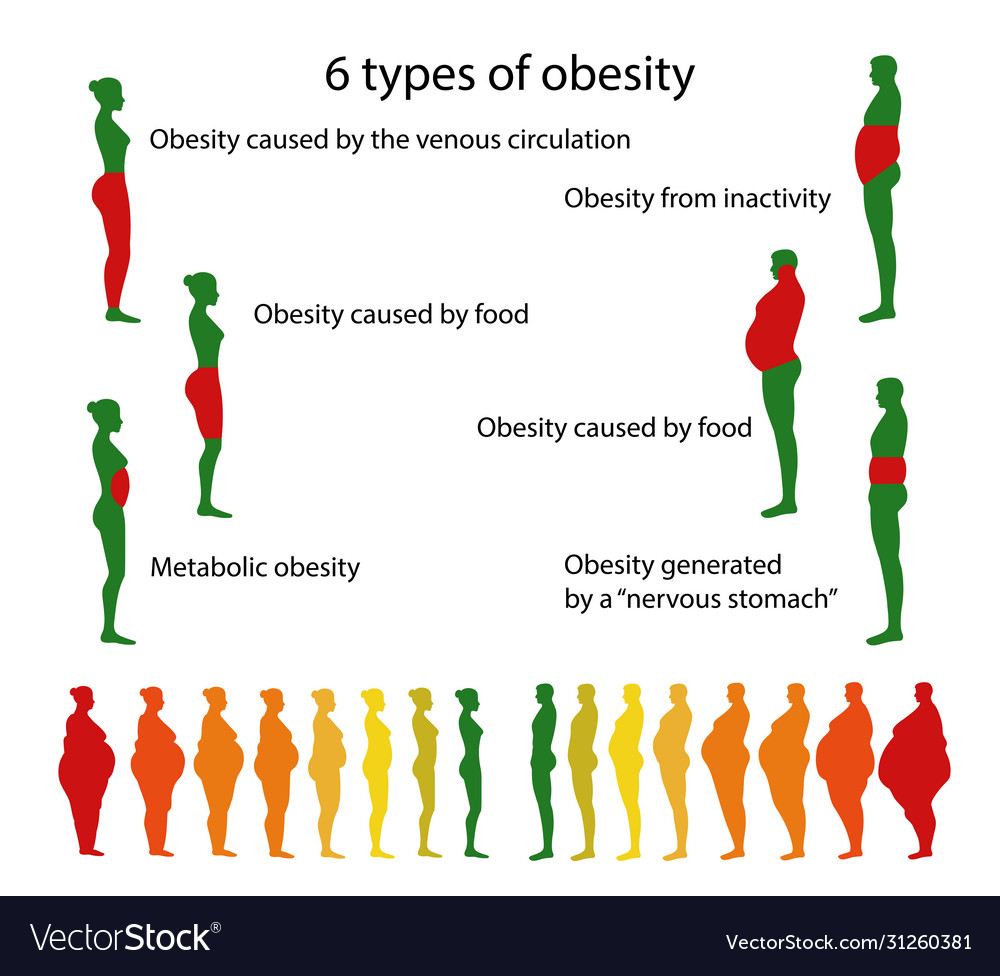 Obesity Royalty Free Vector Image - Vectorstock