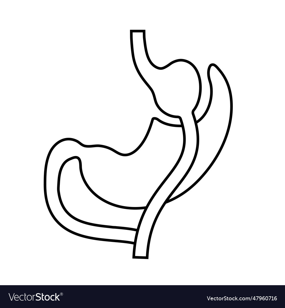 Gastric bypass surgery Royalty Free Vector Image