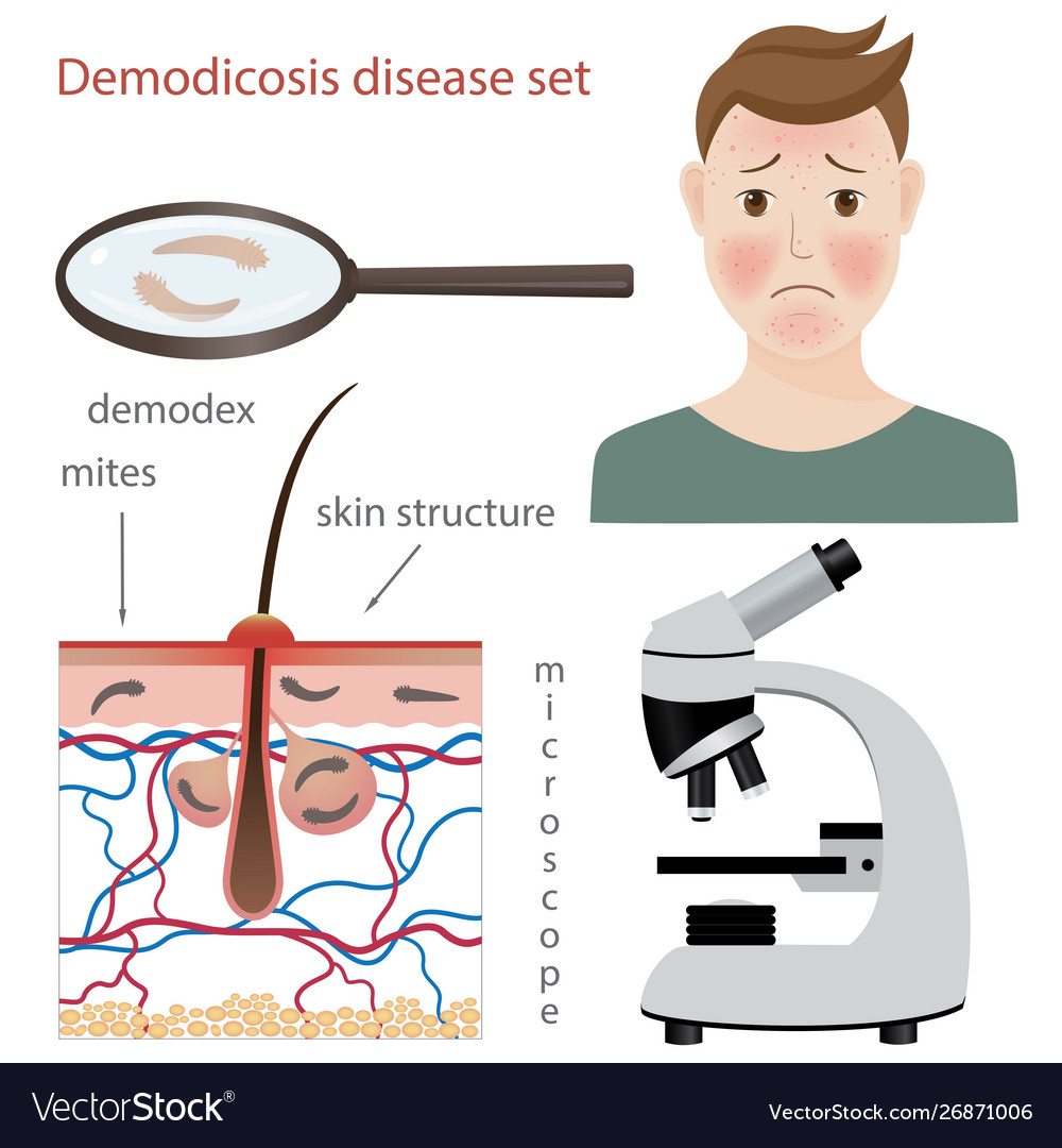 Demodex-01 Royalty Free Vector Image - VectorStock