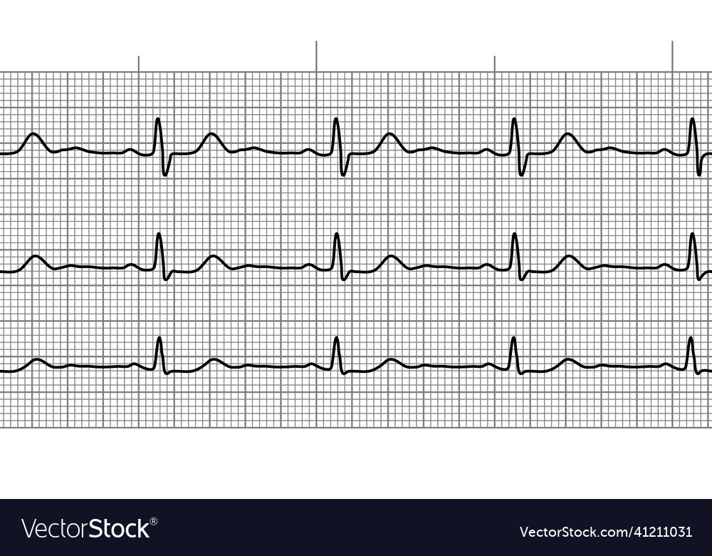 Heart beat ecg or ekg seamless line on black Vector Image