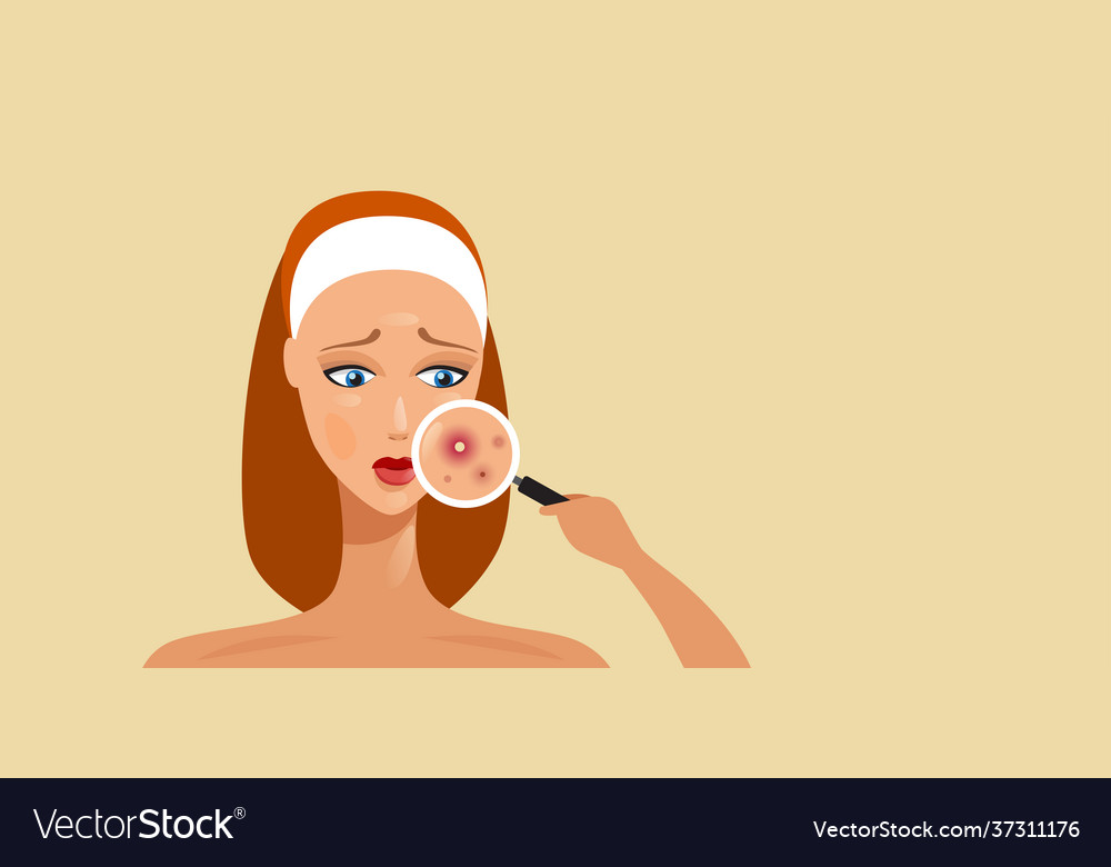 Woman having facial skin problems girl using Vector Image