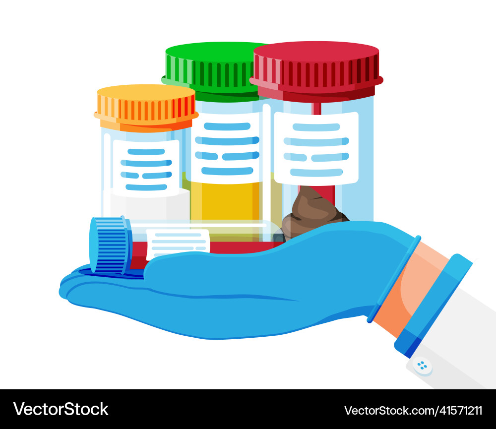 Test tubes with caps stool blood urine sperm Vector Image