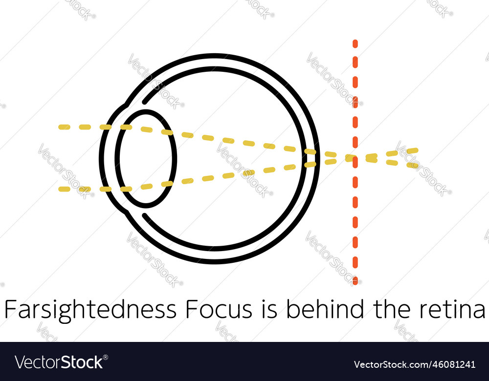Medical of visual acuity and refractive error Vector Image