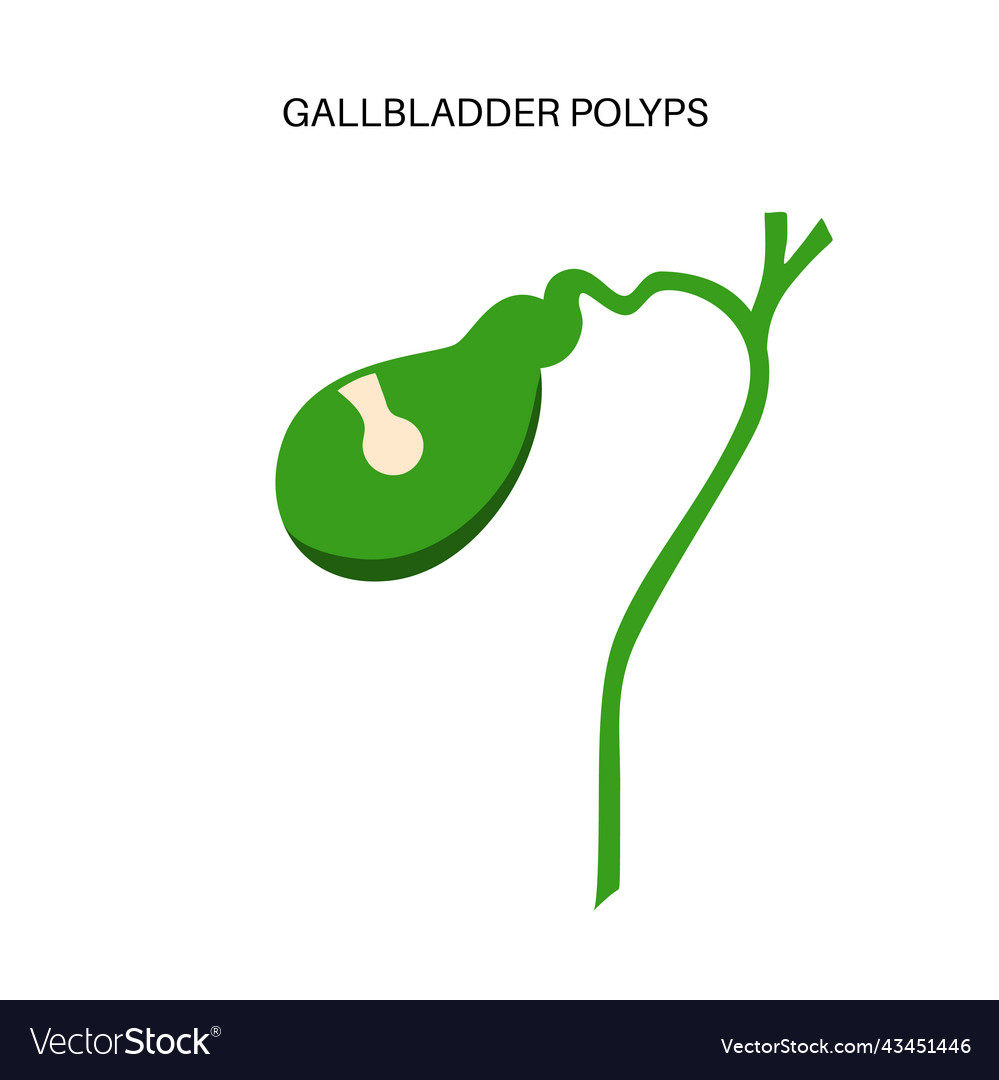 Gallbladder polyp anatomy