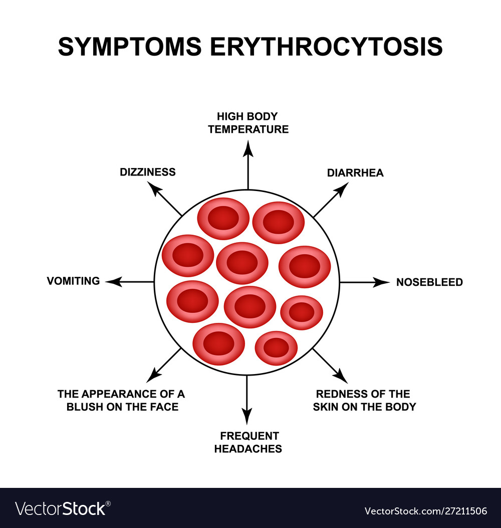 erythrocytosis-symptoms-an-increase-royalty-free-vector