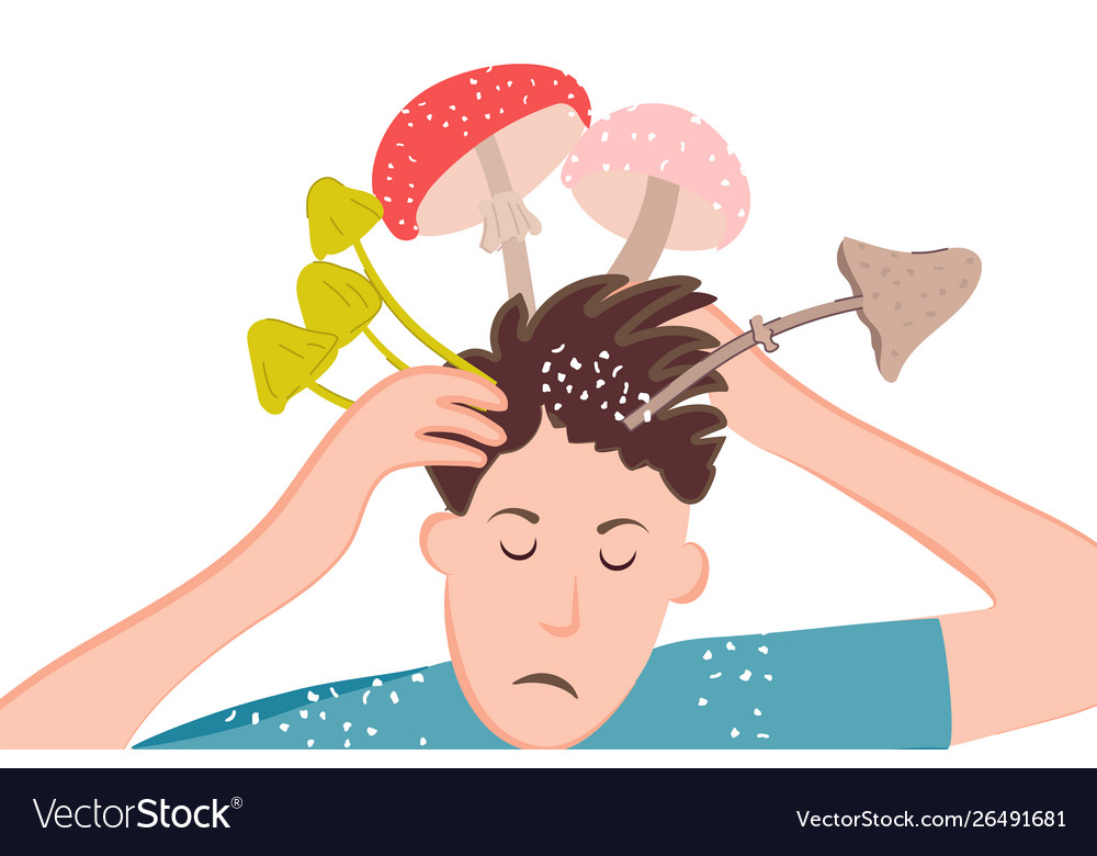 Fungal diseases scalp Royalty Free Vector Image Fungal diseases scalp Royalty Free Vector Image