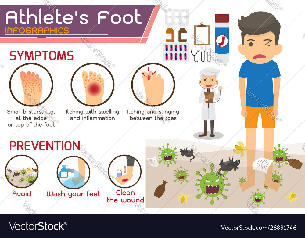 Athletes foot or hong kong foot disease Royalty Free Vector