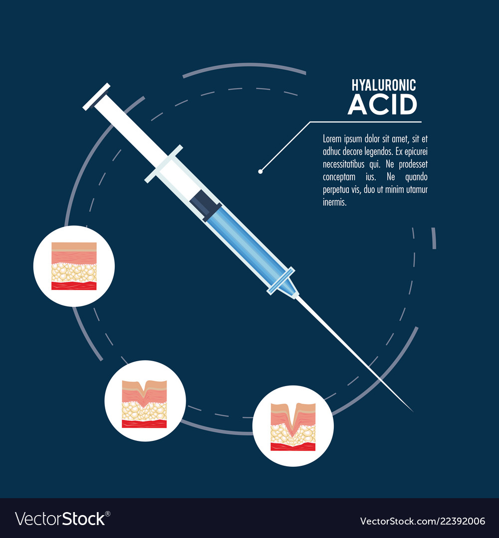 Hyaluronic acid filler injection infographic Vector Image