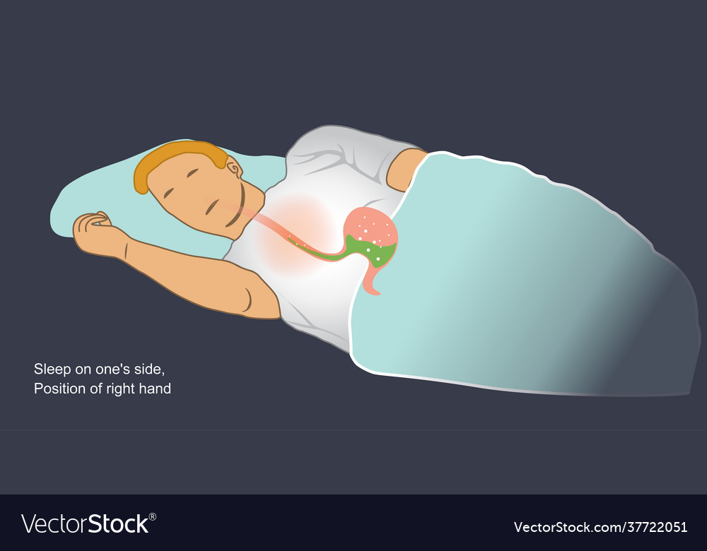 Sleep posture for reflux acids symptom when Vector Image