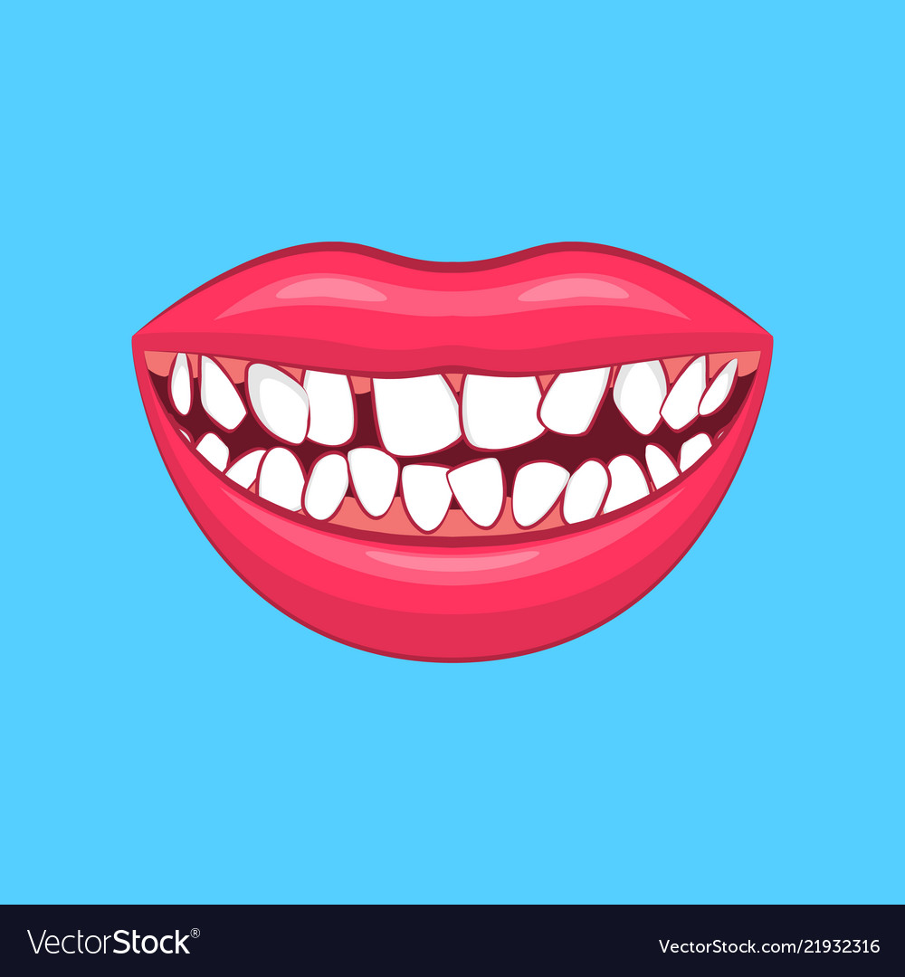 Realistic detailed 3d dental problem on a blue Vector Image