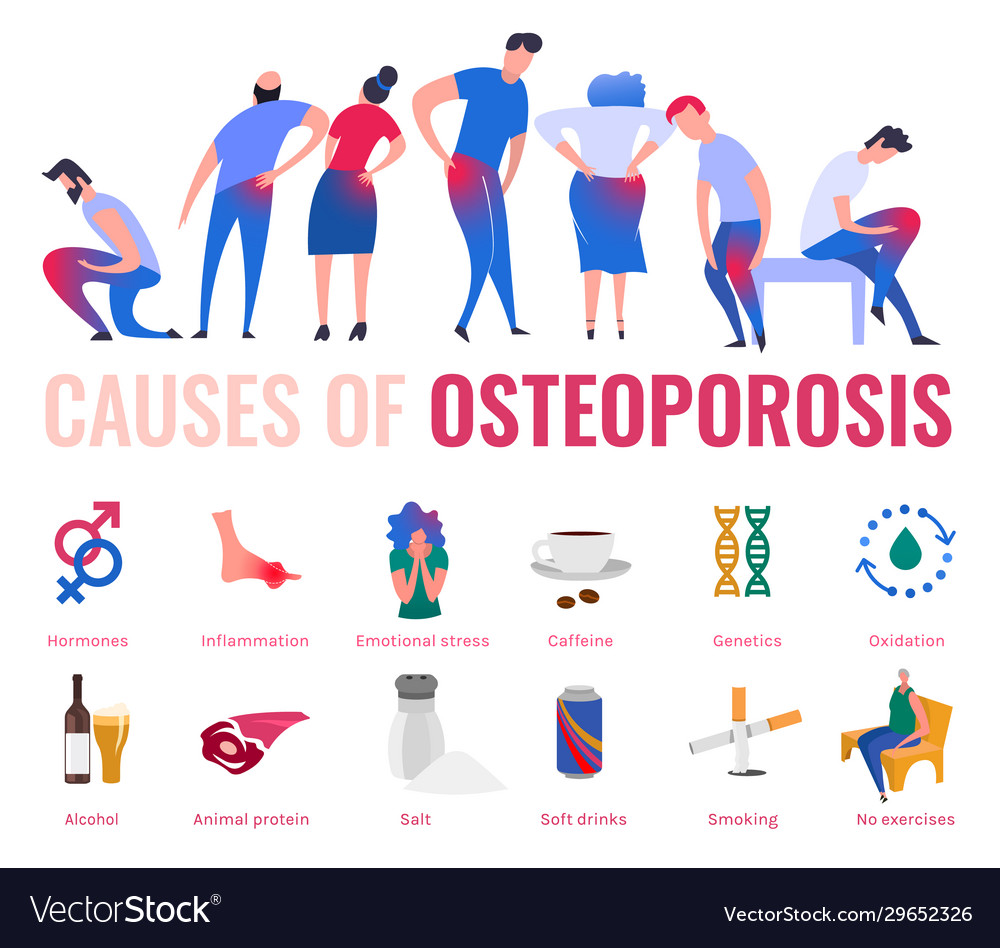 Causes osteoporosis and bone loss Royalty Free Vector Image