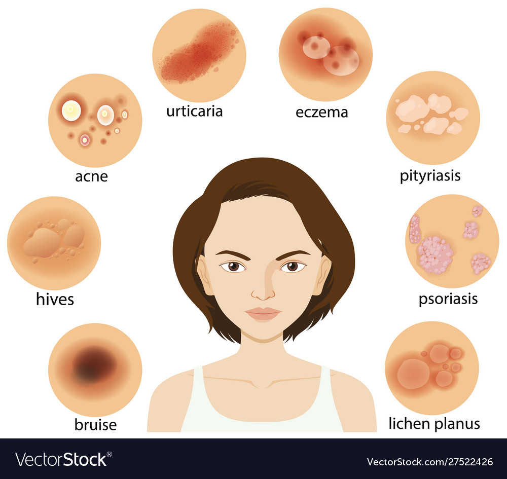 Common Skin Conditions Chart