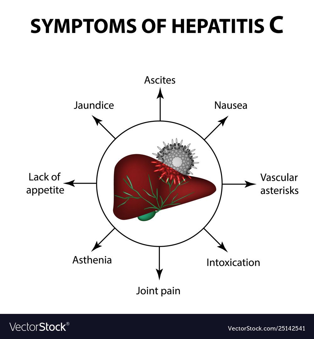 Symptoms Hepatitis C Liver World Hepatitis Vector Image
