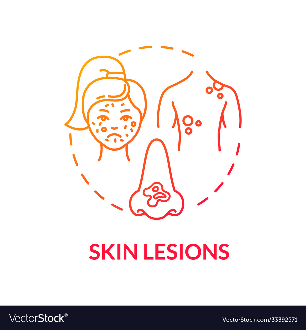 Skin lesions concept icon Royalty Free Vector Image