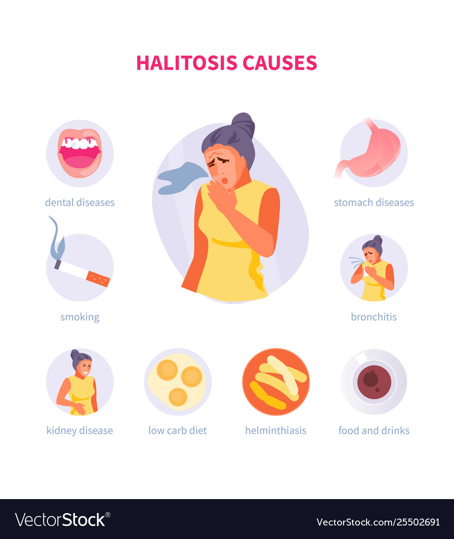 Halitosis causes Royalty Free Vector Image - VectorStock