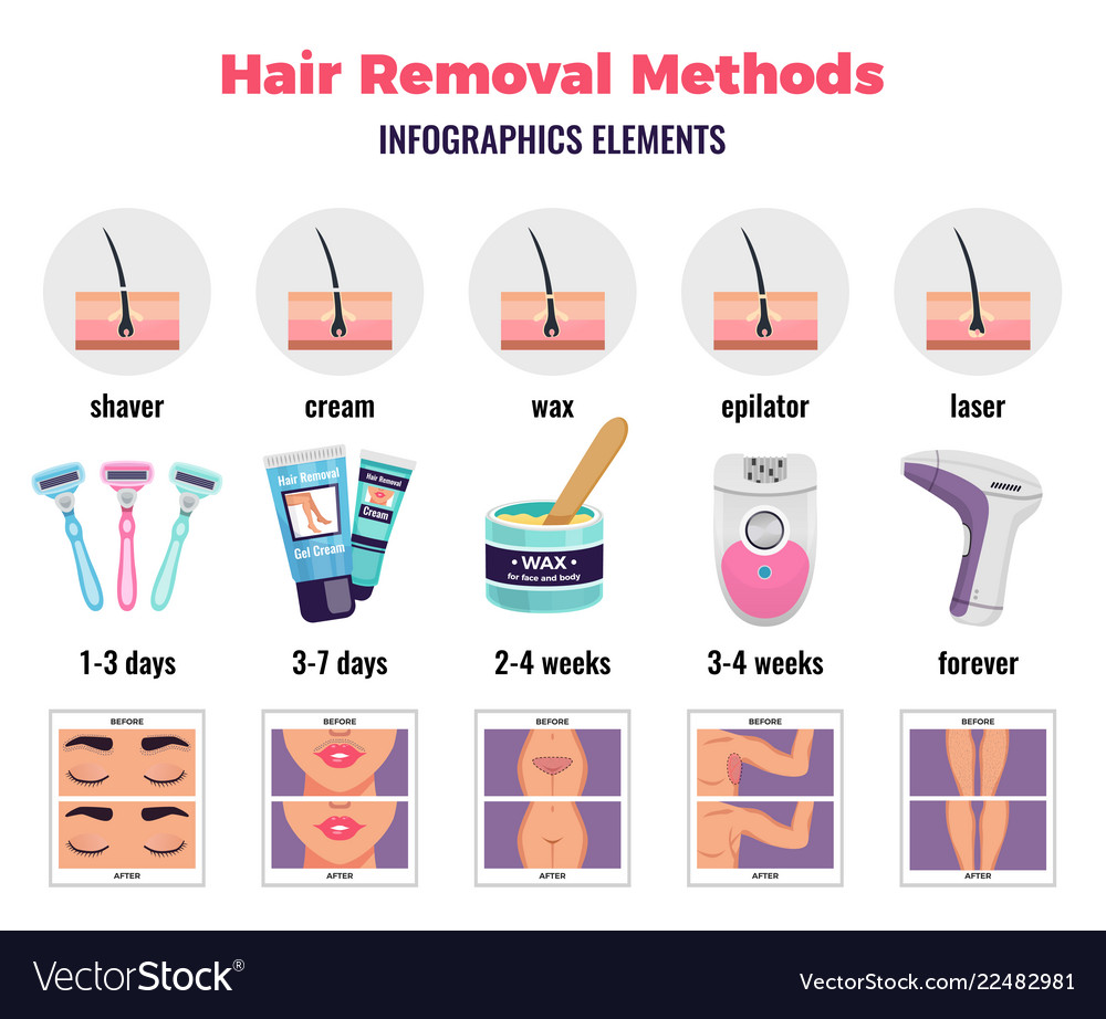 Depilation infographic elements Royalty Free Vector Image