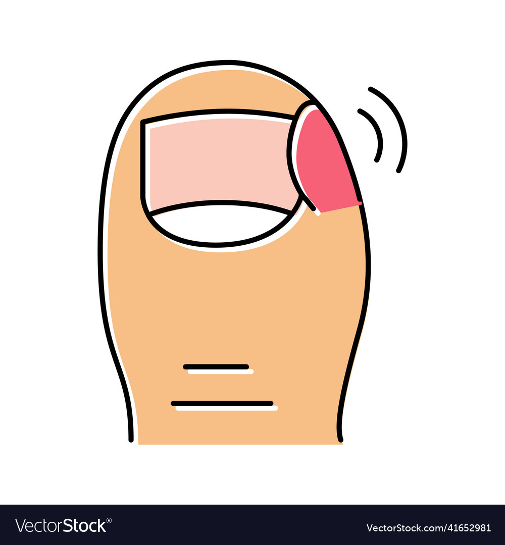 Ingrown nail pain color icon Royalty Free Vector Image