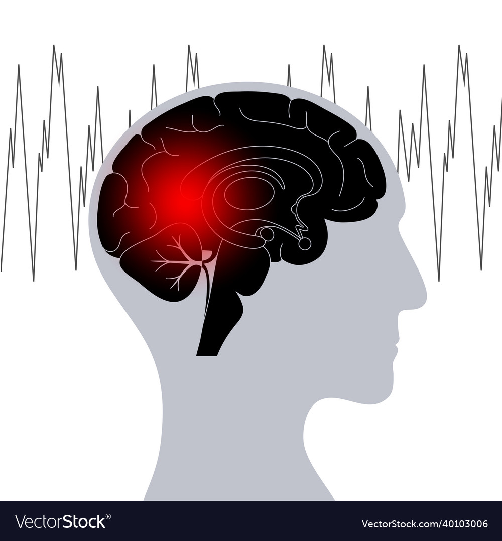 Epilepsy seizure or headache Royalty Free Vector Image