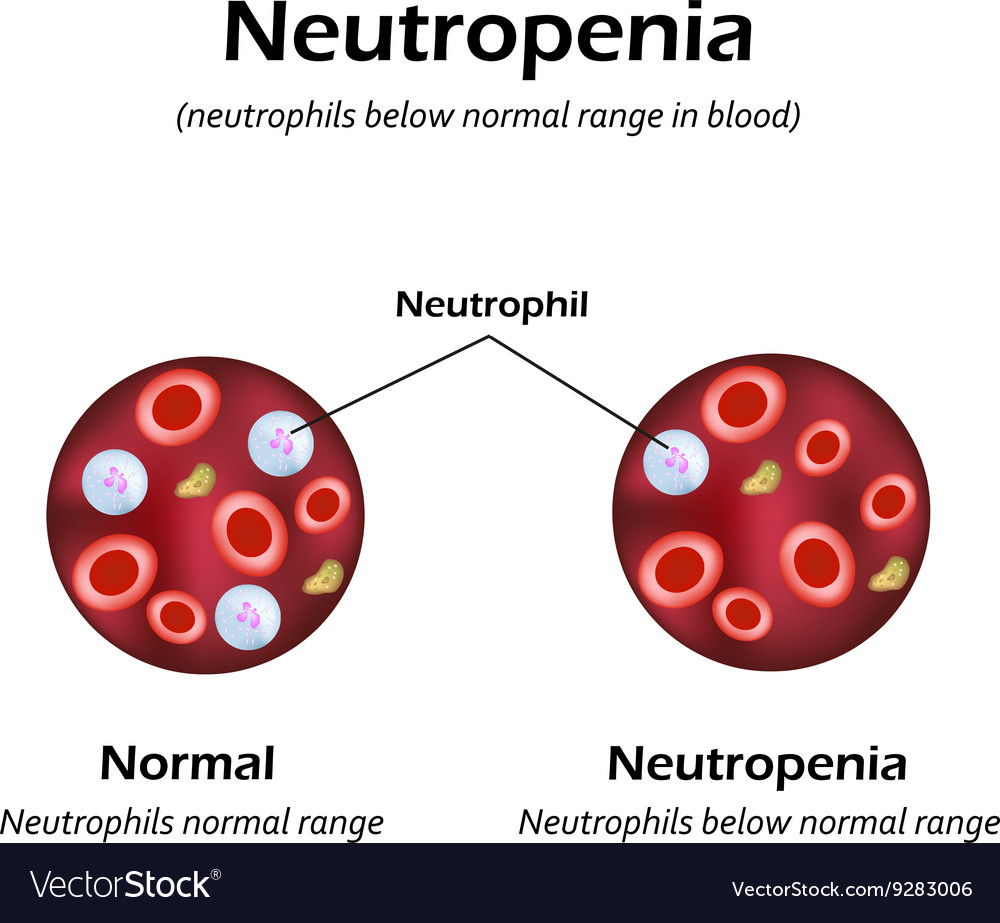 neutrophils-below-the-normal-range-in-the-blood