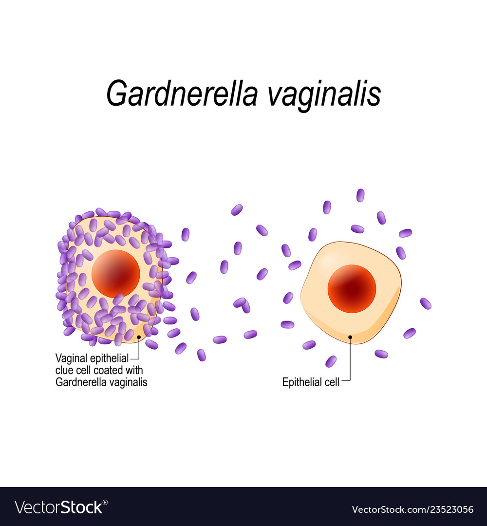 gardnerella vaginalus gardnerella vaginalus
