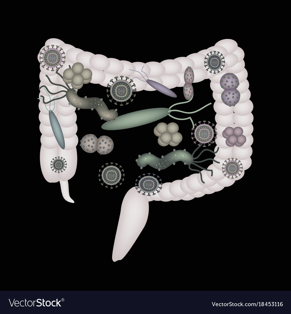 Dysbacteriosis intestine colon bacteria Royalty Free Vector