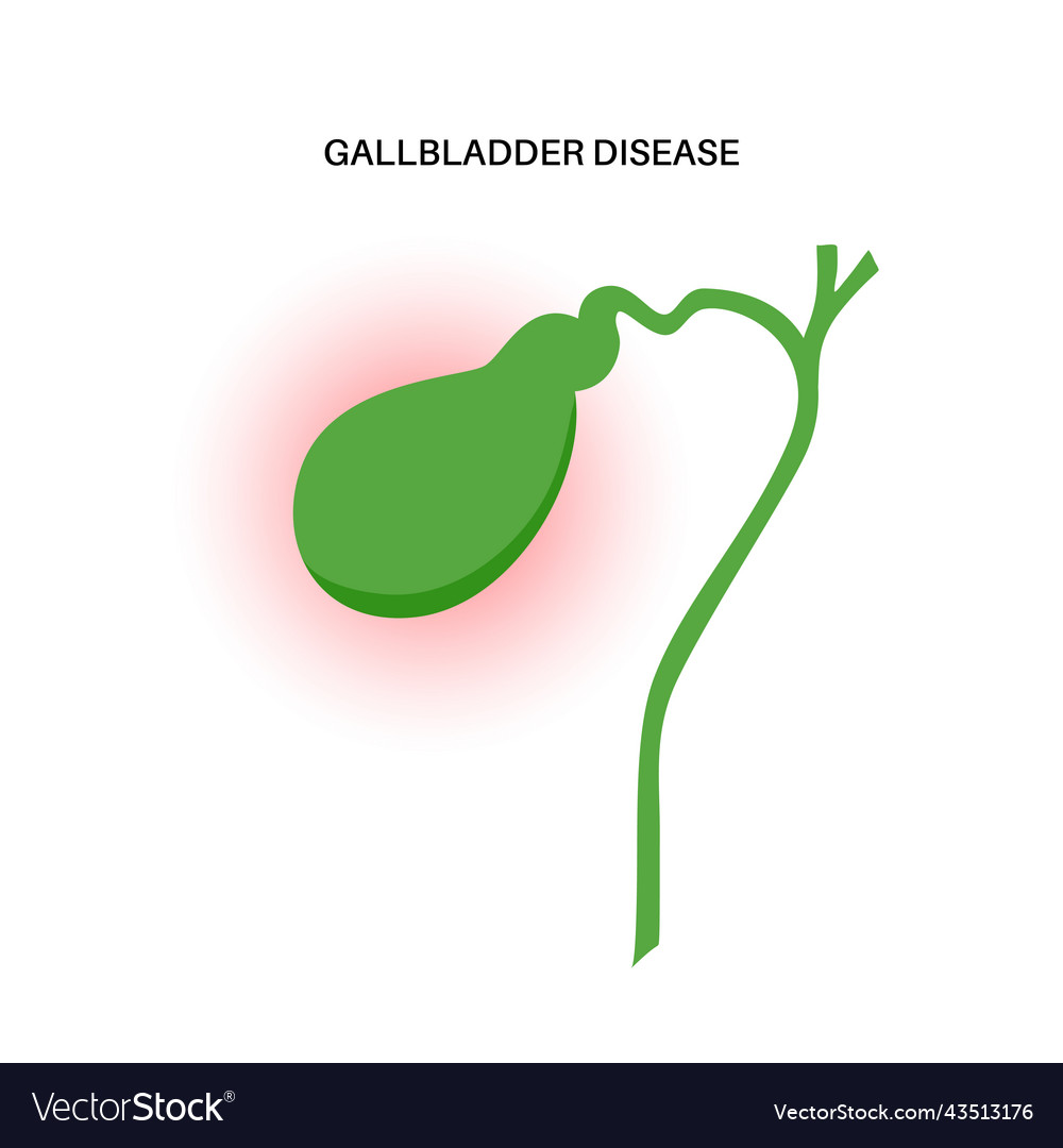 Gallbladder disease poster