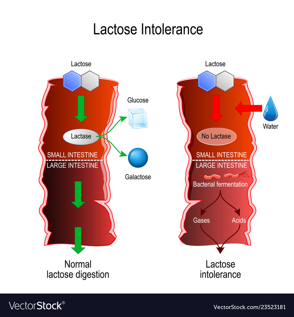 lactose-intolerance-or-lactose-digestion-small-vector-image