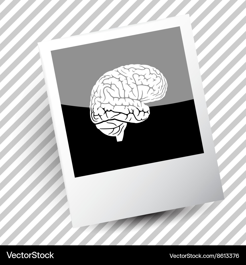Brain Royalty Free Vector Image - VectorStock