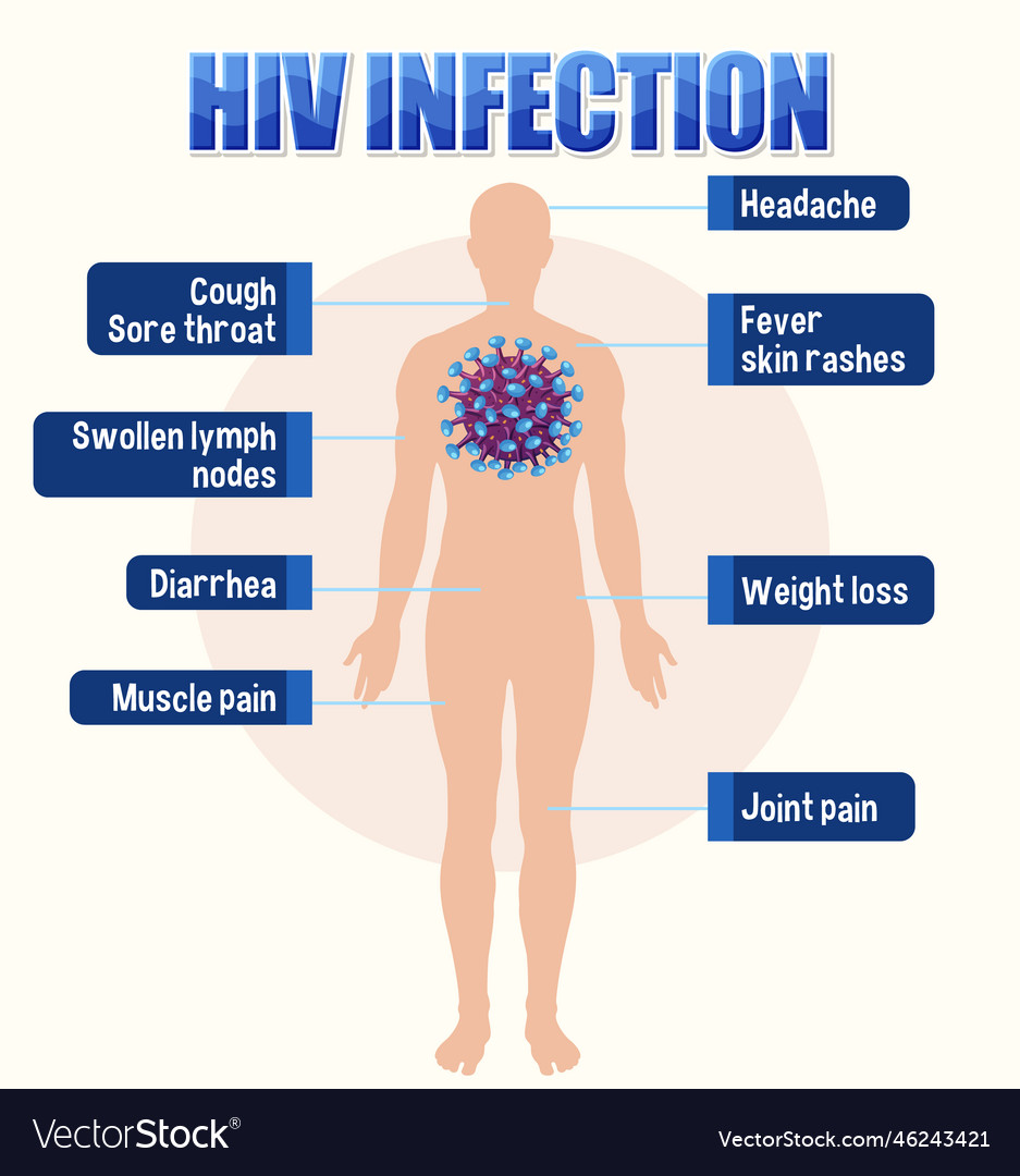 Informative Poster Of Of Hiv Infection Royalty Free Vector