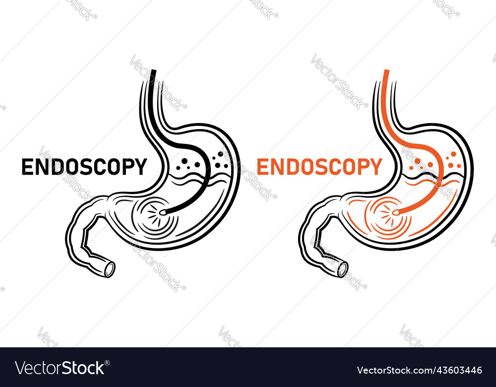 Endoscopy stomach endoscope gastroscopy procedure Vector Image