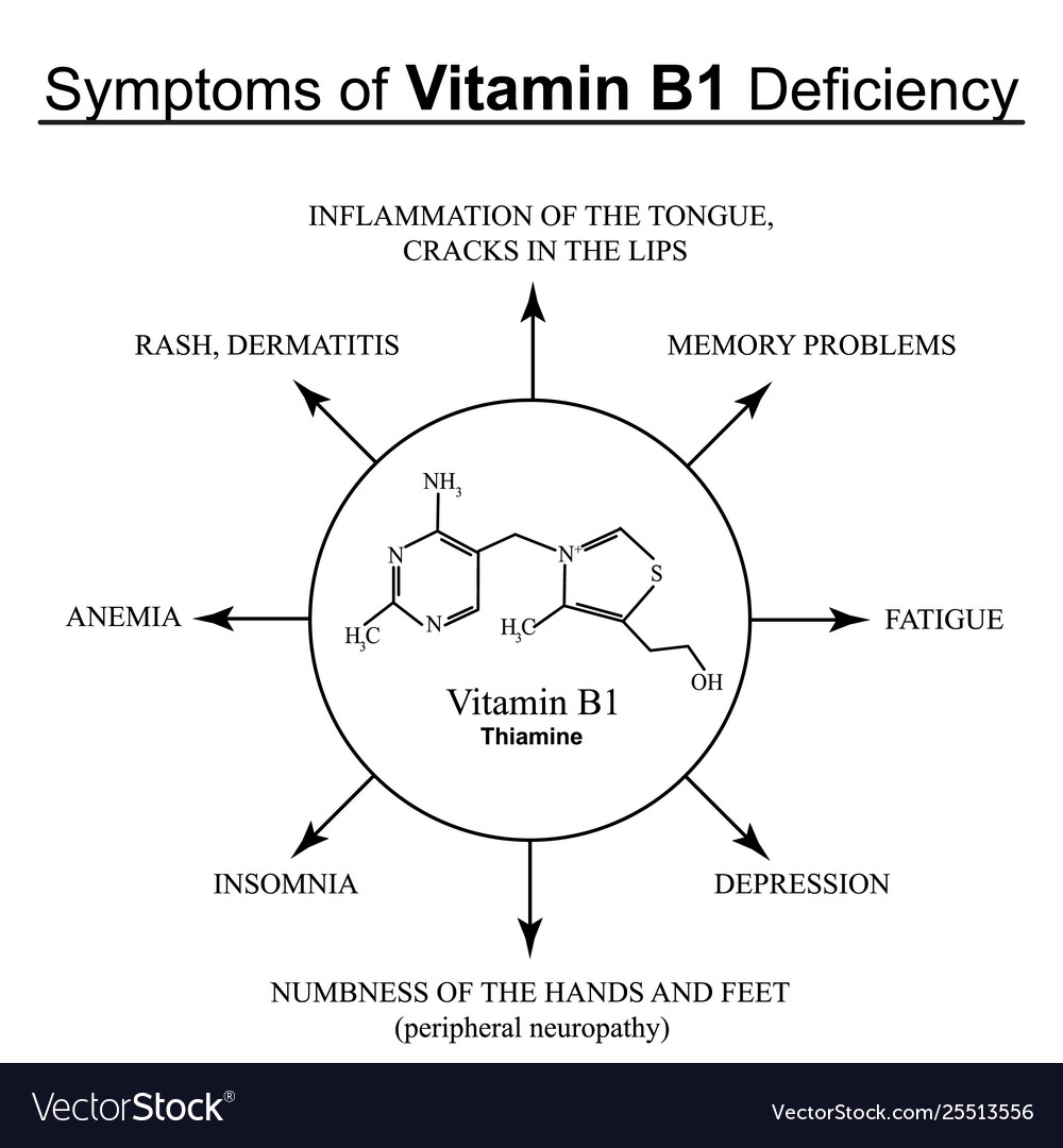 Symptoms Vitamin B1 Deficiency Infographics Vector Image