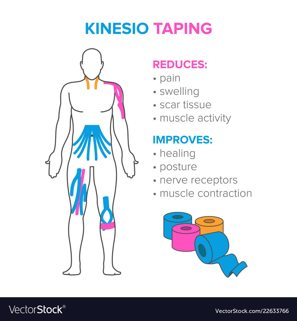 illustrated kinesio taping download