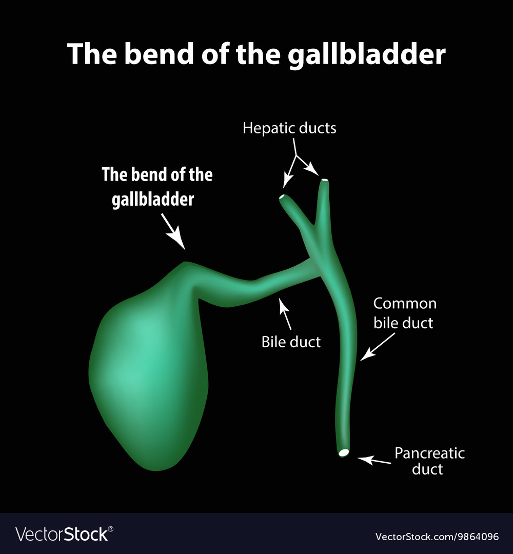 Bend of the gallbladder: causes, clinical manifestations, treatment Bend of the gallbladder: causes, clinical manifestations, treatment
