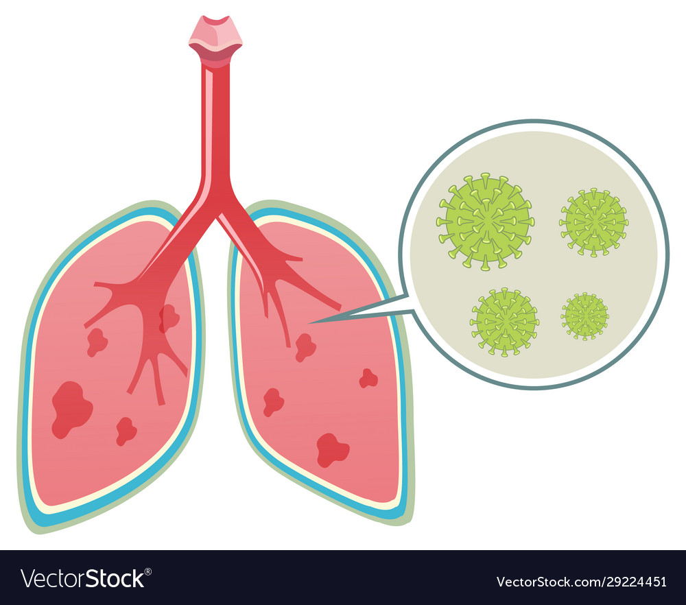 Diagram showing coronavirus in human lungs Vector Image