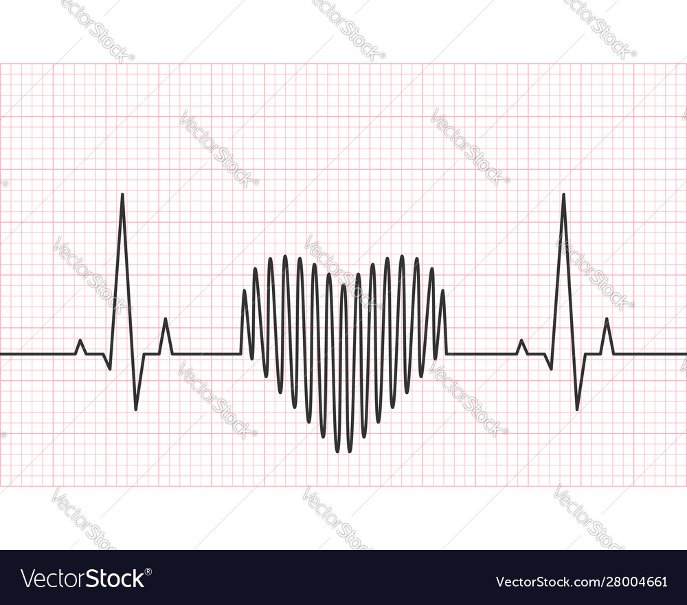 Heart Rate Line With Grid In Background Royalty Free Vector