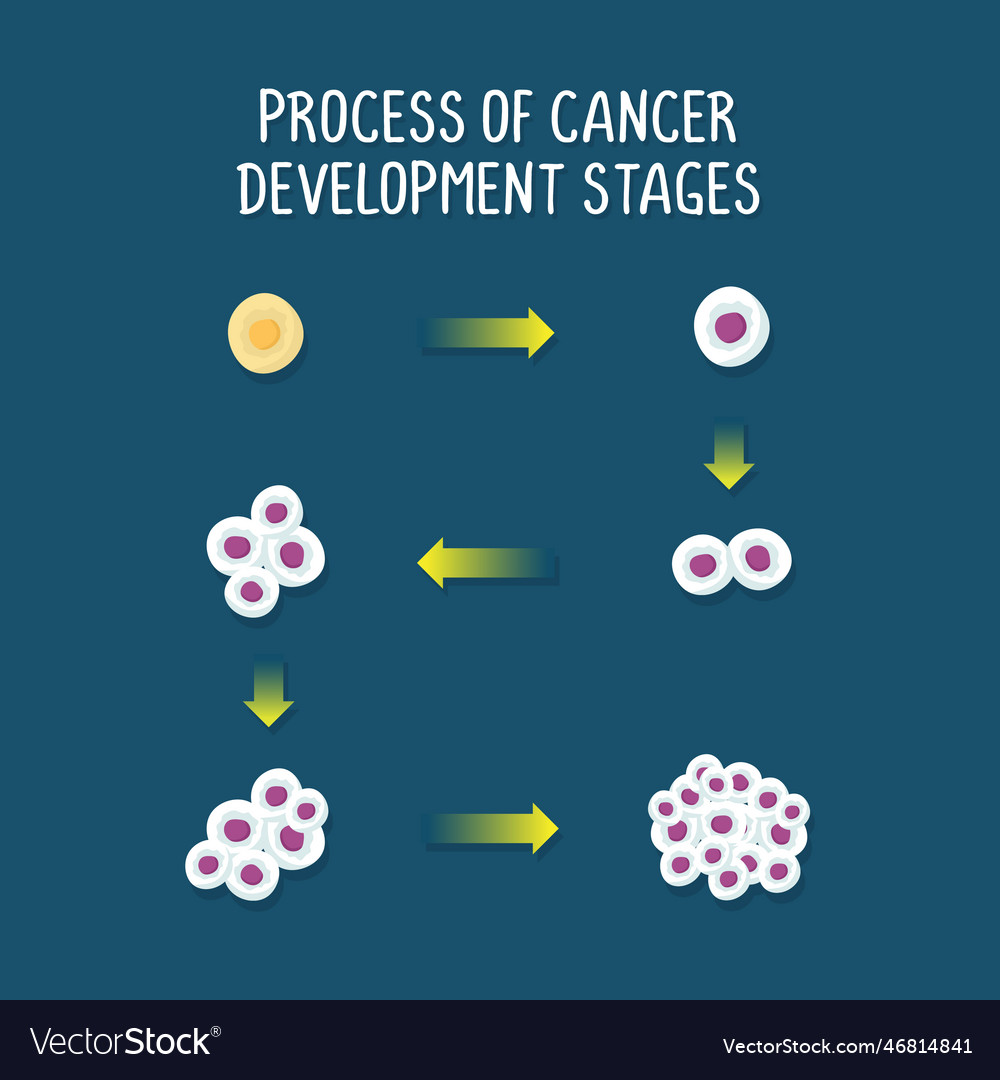 Process of cancer development stages isolated Vector Image