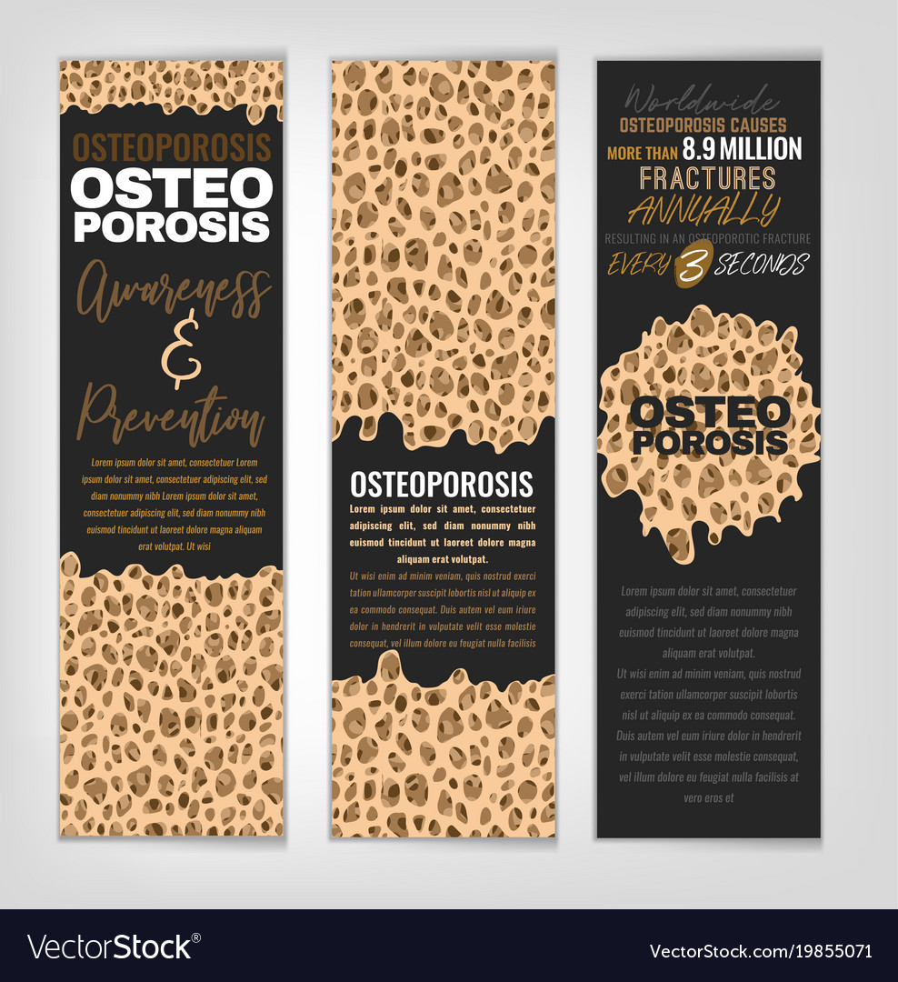 Osteoporosis banners set