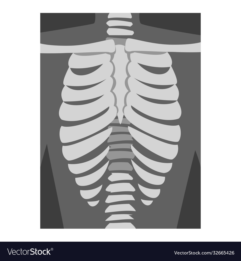 Roentgenograph spine and back bone image Vector Image