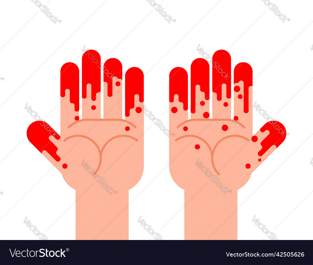 Hands stained with blood isolated on fingers