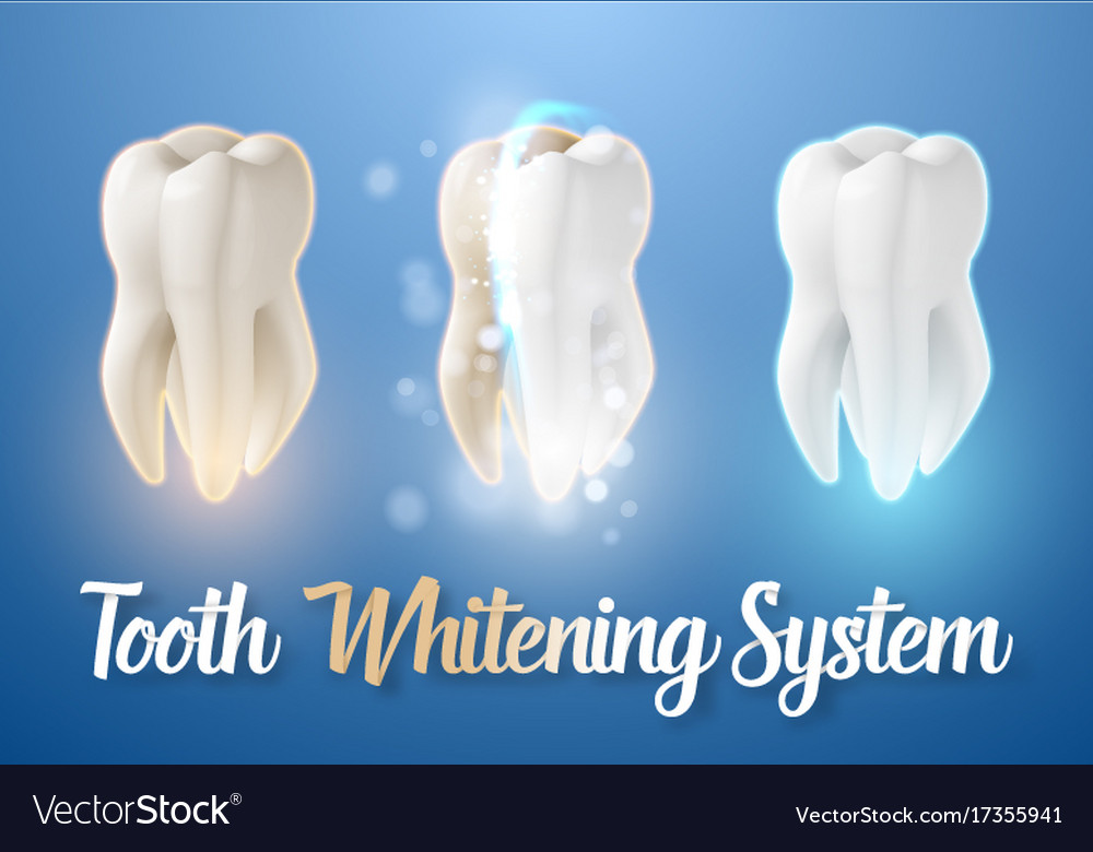 Teeth cleaning process 3d realistic teeth Vector Image