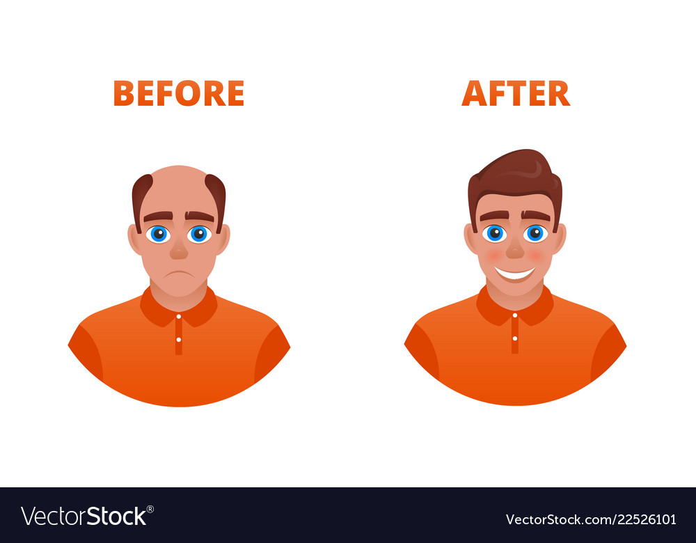 Hair growth concept Royalty Free Vector Image - VectorStock Hair growth concept Royalty Free Vector Image - VectorStock