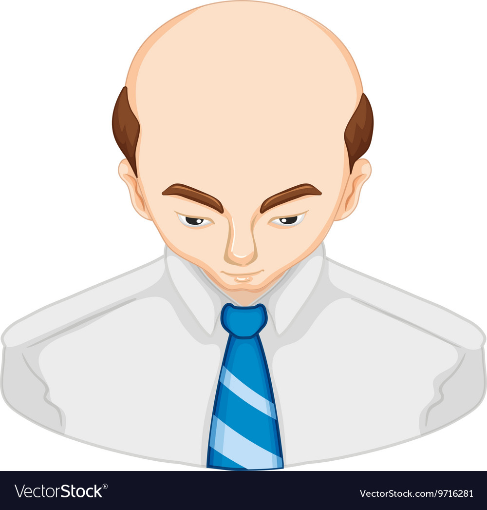 Man lossing hair diagram Royalty Free Vector Image