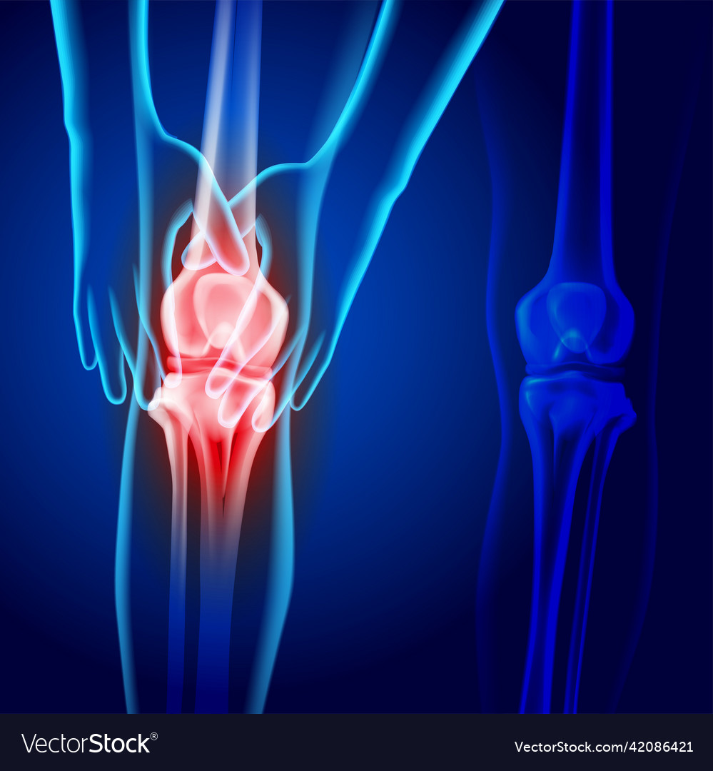 X-ray image of two hands holding knee showing Vector Image