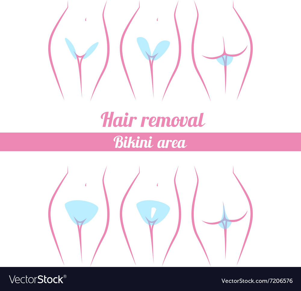 Scheme of hair removal bikini area Royalty Free Vector Image