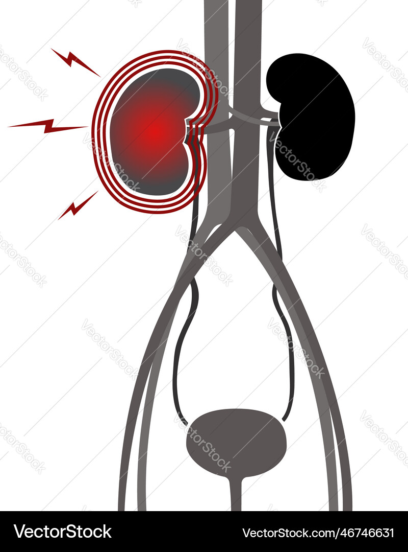 Urinary system Royalty Free Vector Image - VectorStock