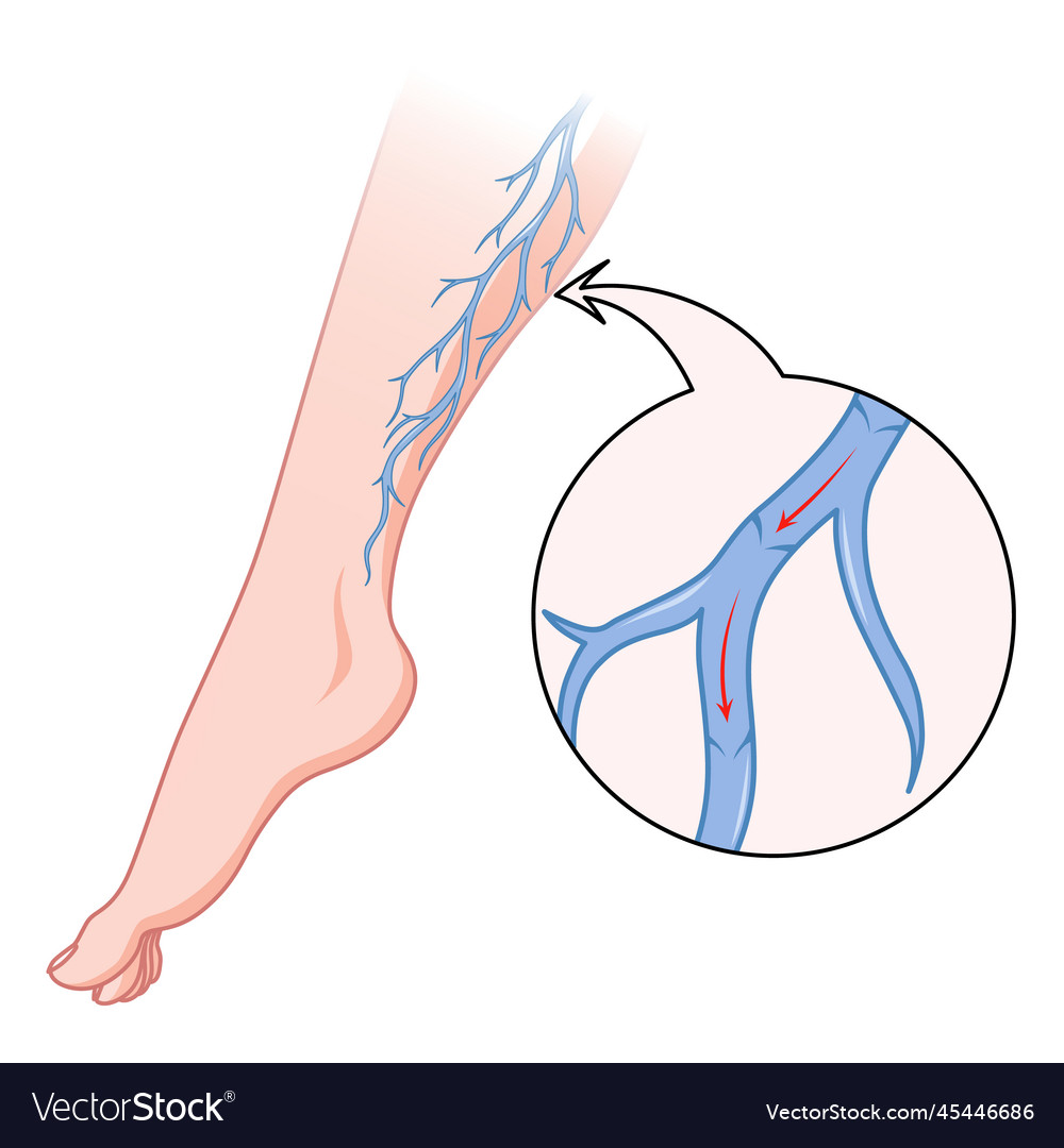 Varicose veins blue blood vessel visible through Vector Image