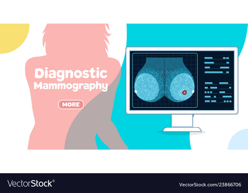 Diagnostic Mammography Banner Royalty Free Vector Image
